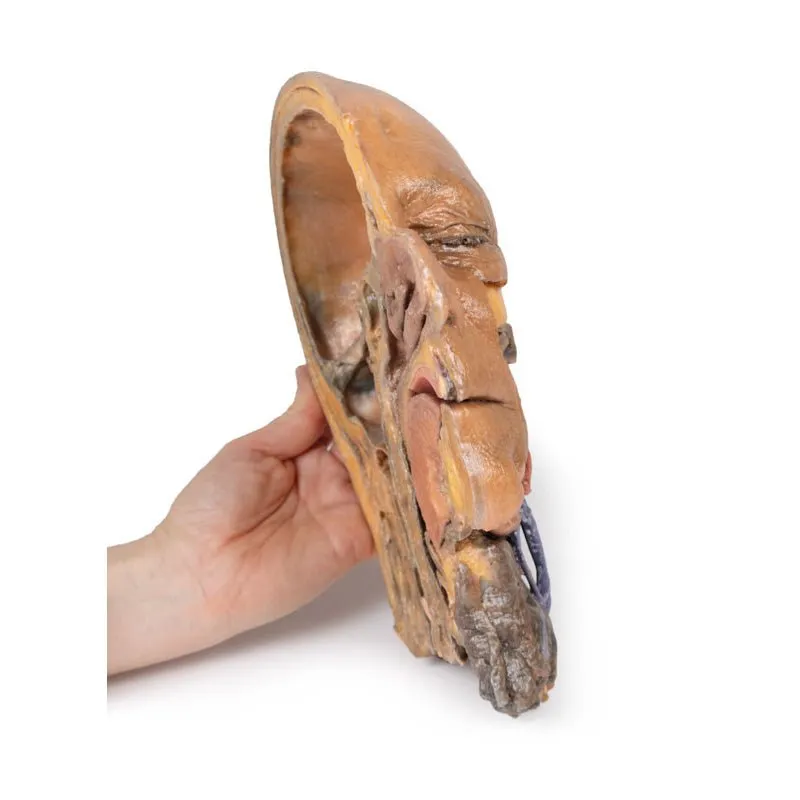 3D Printed Sagittal Section of Head and Neck with Infratemporal Fossa and Carotid Sheath Dissection