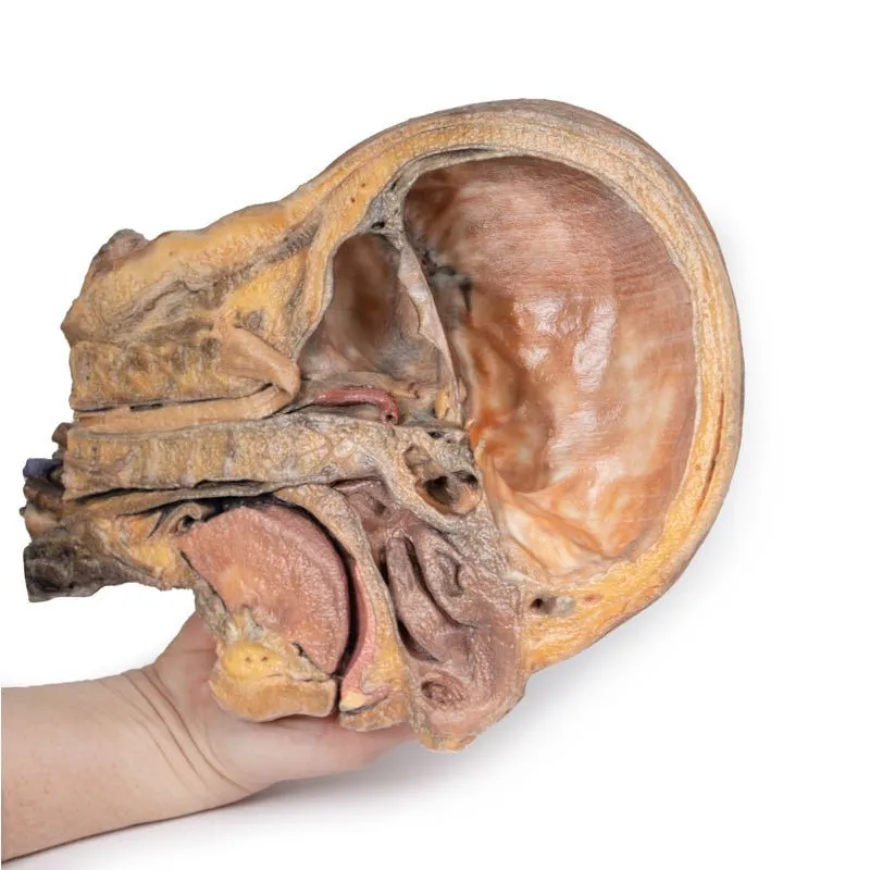 3D Printed Sagittal Section of Head and Neck with Infratemporal Fossa and Carotid Sheath Dissection