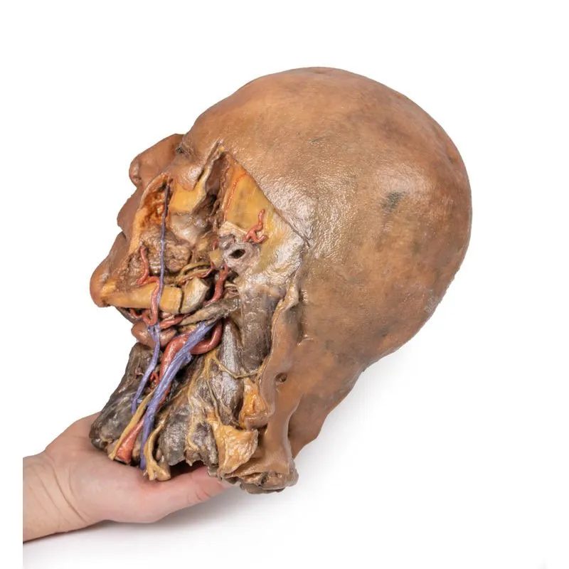 3D Printed Sagittal Section of Head and Neck with Infratemporal Fossa and Carotid Sheath Dissection