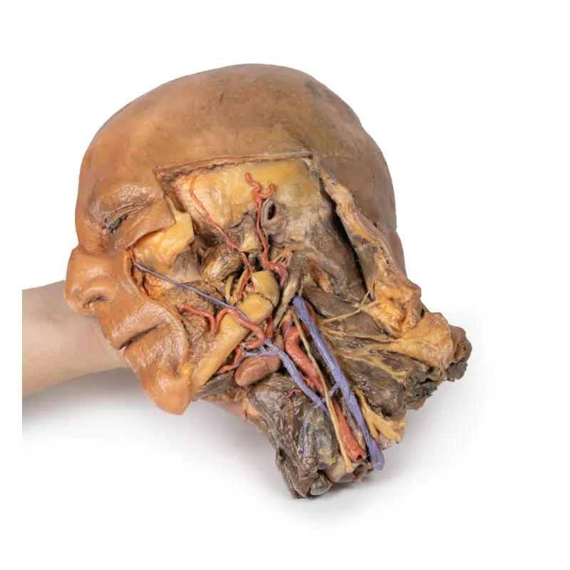 3D Printed Sagittal Section of Head and Neck with Infratemporal Fossa and Carotid Sheath Dissection